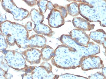 Anti-TIMP2 (Tissue Inhibitor of Metalloproteinase 2) Monoclonal Antibody(Clone: TIMP2/2044)