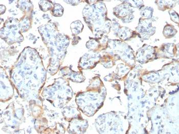 Anti-TIMP2 (Tissue Inhibitor of Metalloproteinase 2) Monoclonal Antibody(Clone: rTIMP2/2335)