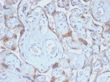 Anti-TIMP2 (Tissue Inhibitor of Metalloproteinase 2) Monoclonal Antibody(Clone: TIMP2/2488R)