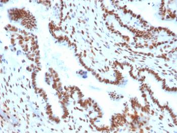 Anti-TLE1 (Synovial Sarcoma Marker) Monoclonal Antibody(Clone: TLE1/2051)