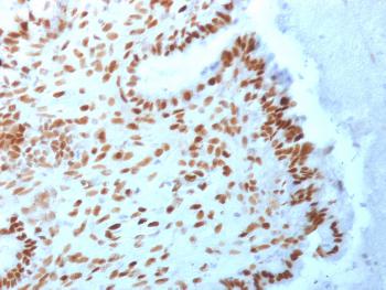 Anti-TLE1 (Synovial Sarcoma Marker) Monoclonal Antibody(Clone: TLE1/2062)