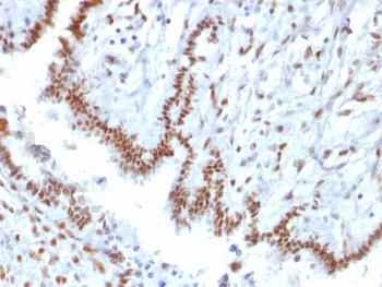 Anti-TLE1 (Synovial Sarcoma Marker) Monoclonal Antibody(Clone: TLE1/2085)