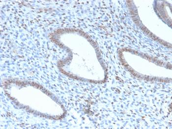 Anti-TLE1 (Synovial Sarcoma Marker) Monoclonal Antibody(Clone: TLE1/2946R)