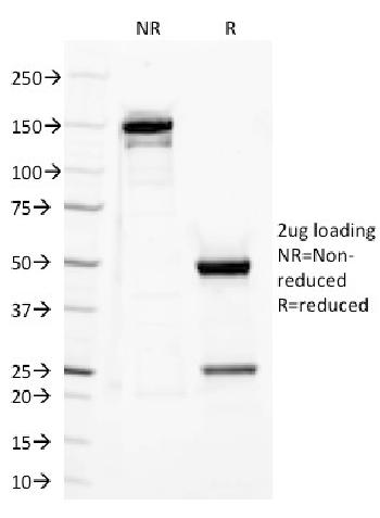 Anti-CD282 (Toll-Like Receptor 2) Monoclonal Antibody(Clone: TLR2/221)