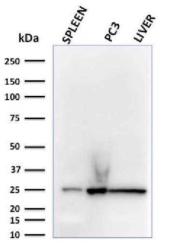 Anti-C1QA / Complement C1q A-Chain Monoclonal Antibody(Clone: C1QA/2783)