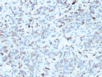 Anti-C1QA / Complement C1q A-Chain Monoclonal Antibody(Clone: C1QA/2952)