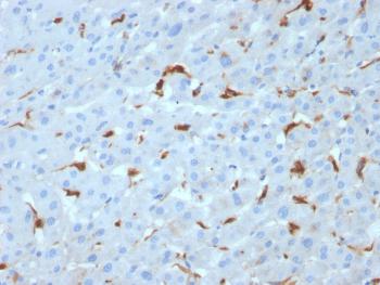 Anti-C1QA / Complement C1q A-Chain Monoclonal Antibody(Clone: C1QA/2953)