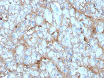 Anti-C1QA / Complement C1q A-Chain Monoclonal Antibody(Clone: C1QA/2954)