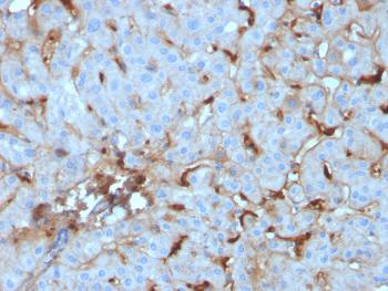 Anti-C1QA / Complement C1q A-Chain Monoclonal Antibody(Clone: C1QA/2955)