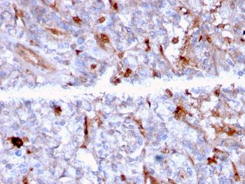 Anti-C1QA / Complement C1q A-Chain Monoclonal Antibody(Clone: C1QA/2956)