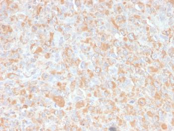 Anti-TNF-alpha (Tumor Necrosis Factor alpha) Monoclonal Antibody(Clone: 4C6-H8)