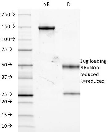 Anti-TNF-alpha (Tumor Necrosis Factor alpha) Monoclonal Antibody(Clone: J2D10)