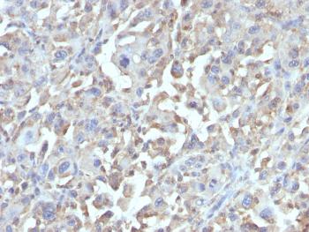 Anti-TNF-alpha (Tumor Necrosis Factor alpha) Monoclonal Antibody(Clone: MAb1)