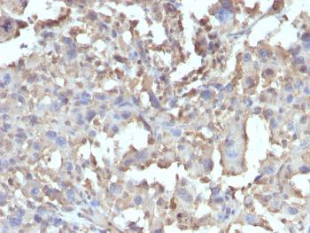 Anti-TNF-alpha (Tumor Necrosis Factor alpha) Monoclonal Antibody(Clone: TNF/1500R)