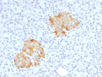 Anti-TNF-alpha (Tumor Necrosis Factor alpha) Polyclonal Antibody