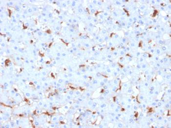 Anti-C1QB / Complement C1q B-Chain Monoclonal Antibody(Clone: C1QB/2961)