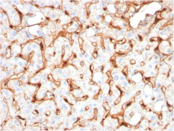 Anti-C1QB / Complement C1q B-Chain Monoclonal Antibody(Clone: C1QB/2965)