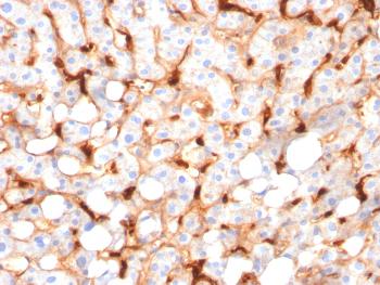 Anti-C1QB / Complement C1q B-Chain Monoclonal Antibody(Clone: C1QB/2966)