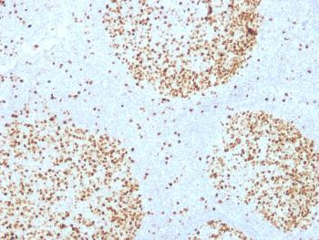 Anti-Topoisomerase II alpha (Proliferation & Drµg-Resistance Marker) Monoclonal Antibody(Clone: TOP2A/1361)