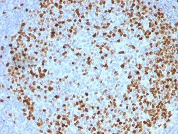 Anti-Topoisomerase II alpha (Proliferation & Drµg-Resistance Marker) Monoclonal Antibody(Clone: TOP2A/1362)