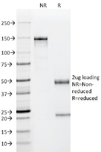 Anti-p53 Tumor Suppressor Protein Monoclonal Antibody(Clone: PAb122)