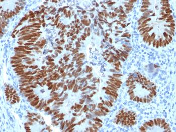 Anti-p53 Tumor Suppressor Protein Polyclonal Antibody