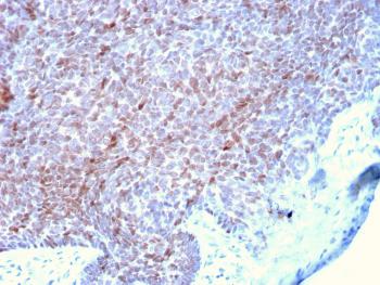 Anti-p73 (Tumor Suppressor) Monoclonal Antibody(Clone: P73/2531)