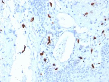 Anti-Tryptase (Mast Cell Marker) Monoclonal Antibody(Clone: TPSAB1/1961)