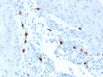 Anti-Tryptase (Mast Cell Marker) Monoclonal Antibody(Clone: TPSAB1/1963)