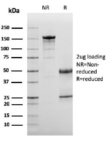 Anti-Complement 3d (C3d) (Acute Humoral Rejection Marker) Monoclonal Antibody(Clone: C3D/2891)