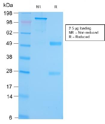 Anti-GRP94 / HSP90B1 (Endoplasmic Reticulum Marker) Monoclonal Antibody(Clone: HSP90B1/3168R)