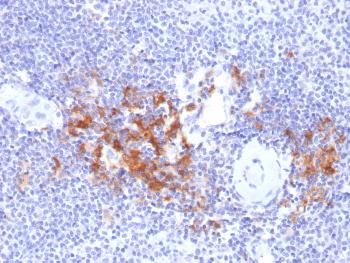 Anti-TRAF1 (TNFR-Associated Factor 1) (Lymphomatoid Papulosis Marker) Monoclonal Antibody(Clone: TRAF1/2770)