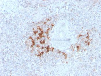 Anti-TRAF1 (TNFR-Associated Factor 1) (Lymphomatoid Papulosis Marker) Monoclonal Antibody(Clone: TRAF1/3298)