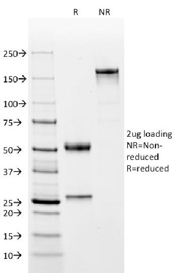 Anti-Complement 4d (C4d) (Acute Humoral Rejection Marker) Monoclonal Antibody(Clone: C4D204)-CF488