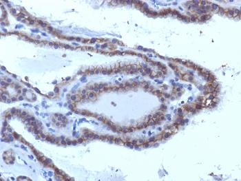 Anti-TSH-Receptor, A-Chain (Thyroid Marker) Monoclonal Antibody(Clone: SPM223)