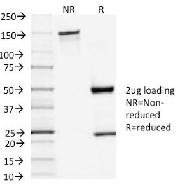 Anti-TSH-Receptor, A-Chain (Thyroid Marker) Monoclonal Antibody(Clone: TSHRA/1402)