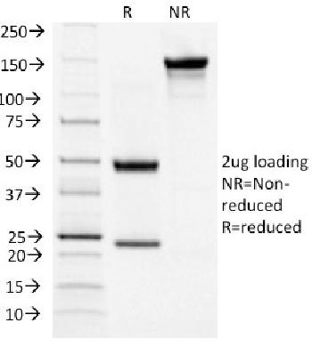 Anti-TSH-Receptor, B-Chain (Thyroid Marker) Monoclonal Antibody(Clone: TSHRB/1404)