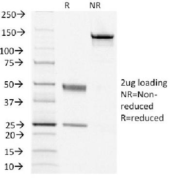 Anti-TSH-Receptor, B-Chain (Thyroid Marker) Monoclonal Antibody(Clone: TSHRB/1405)