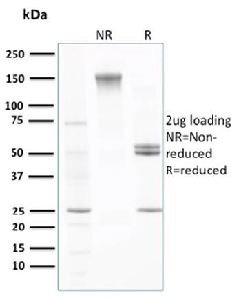 Anti-Transthyretin (Prealbumin) Monoclonal Antibody(Clone: CPTC-TTR-1)