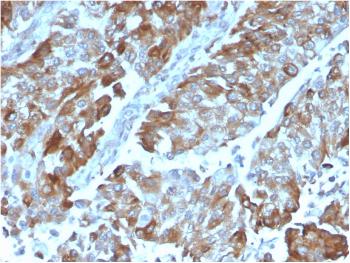 Anti-OX40 / CD134/ TNFRSF4 (Immuno-Oncology Target) Monoclonal Antibody(Clone: OX40/3108)