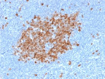 Anti-Thymidylate Synthase (5-FU Resistance Marker) Monoclonal Antibody(Clone: TYMS/1884)