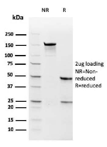 Anti-Thymidylate Synthase (5-FU Resistance Marker) Monoclonal Antibody(Clone: rTYMS/1884)