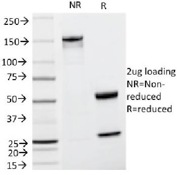 Anti-Tyrosinase-Related Protein-1 (TYRP-1) (Melanoma Marker) Monoclonal Antibody(Clone: TA99)