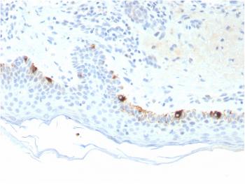 Anti-Tyrosinase-Related Protein-1 (TYRP-1) (Melanoma Marker) Monoclonal Antibody(Clone: TYRP1/3281)