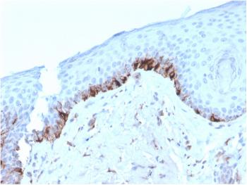 Anti-Tyrosinase-Related Protein-1 (TYRP-1) (Melanoma Marker) Monoclonal Antibody(Clone: TYRP1/3282)