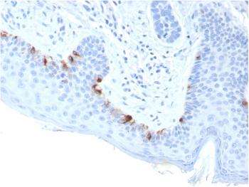 Anti-Tyrosinase-Related Protein-1 (TYRP-1) (Melanoma Marker) Monoclonal Antibody(Clone: TYRP1/3283)