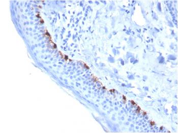 Anti-Tyrosinase-Related Protein-1 (TYRP-1) (Melanoma Marker) Monoclonal Antibody(Clone: TYRP1/3284)