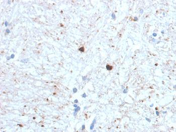 Anti-Ubiquitin (Autophagy Marker) Monoclonal Antibody(Clone: UBB/1748)