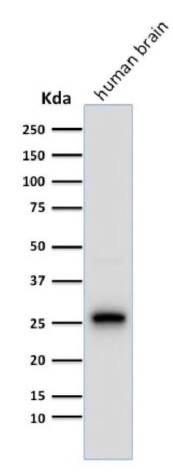 Anti-PGP9.5 / UchL1 (pan-Neuronal Marker) Monoclonal Antibody(Clone: 13C4)