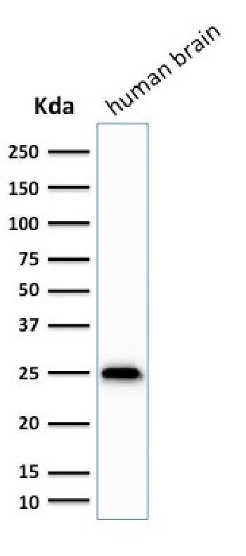 Anti-PGP9.5 / UchL1 Monoclonal Antibody(Clone: SPM575)